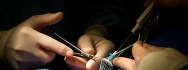 Cardiovascular Surgery