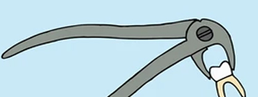 Extracting Forceps American Pattern